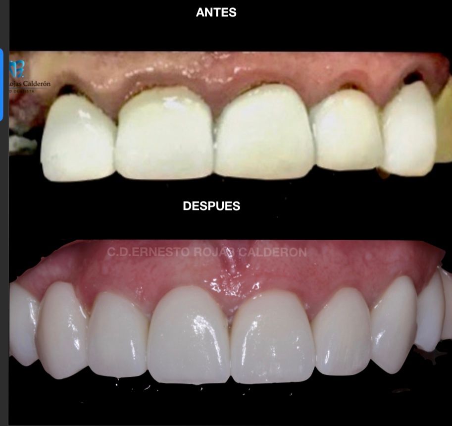 Ernesto Rojas Calderon-39