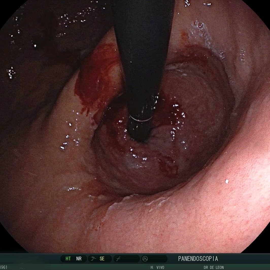 Edgar Alan De León Rojas-9