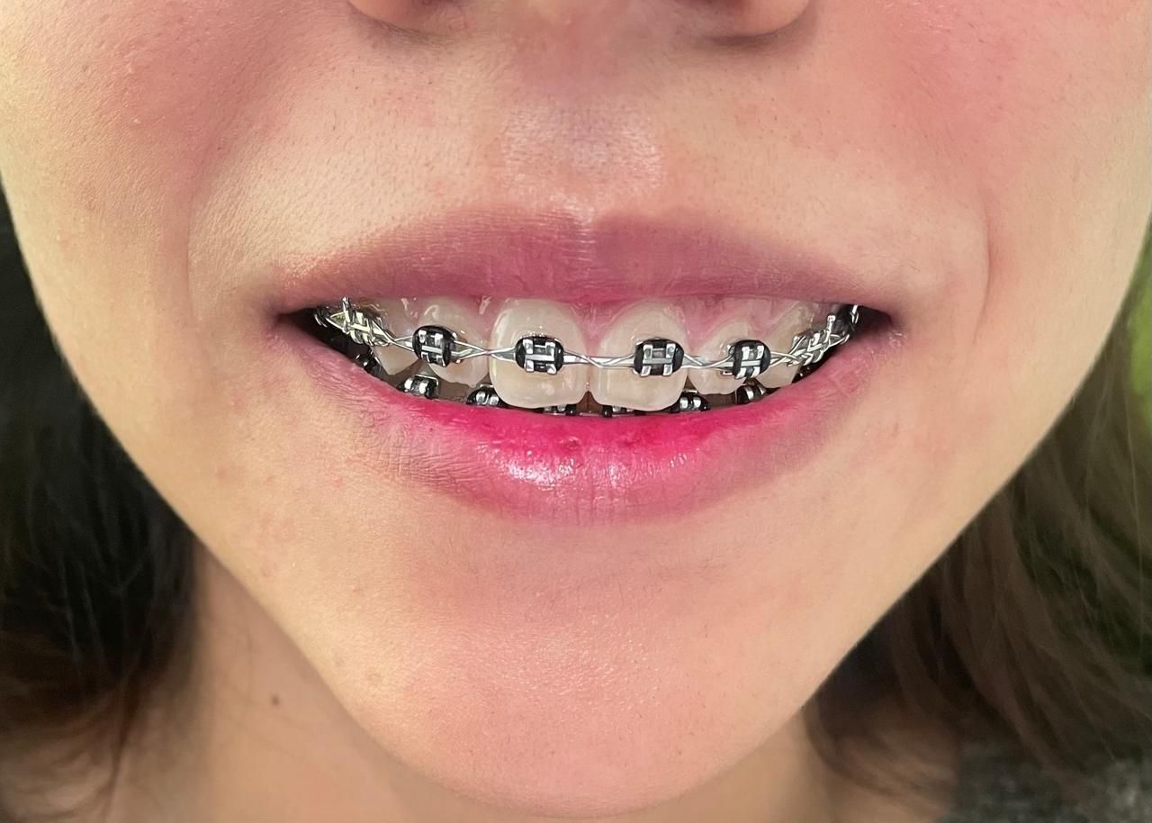 Anuar Becerril Castro-10