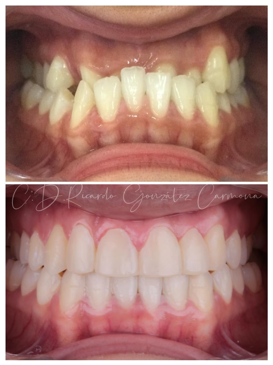 Alicia Carmona López-13