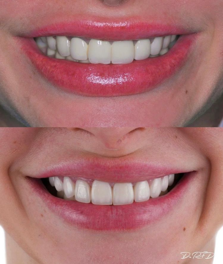 Victoria Eugenia Valderrama León-8