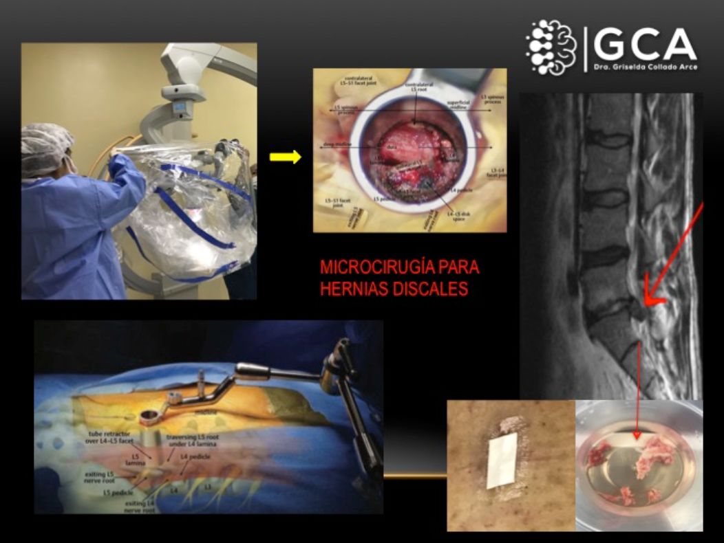 Griselda Collado Arce-28