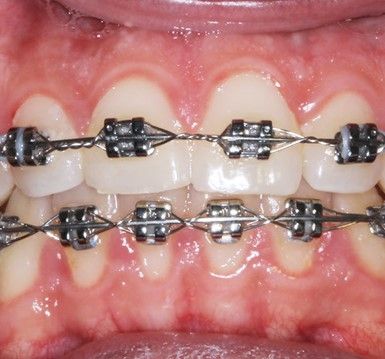 Erika Monserrat Quiroz Martínez-13