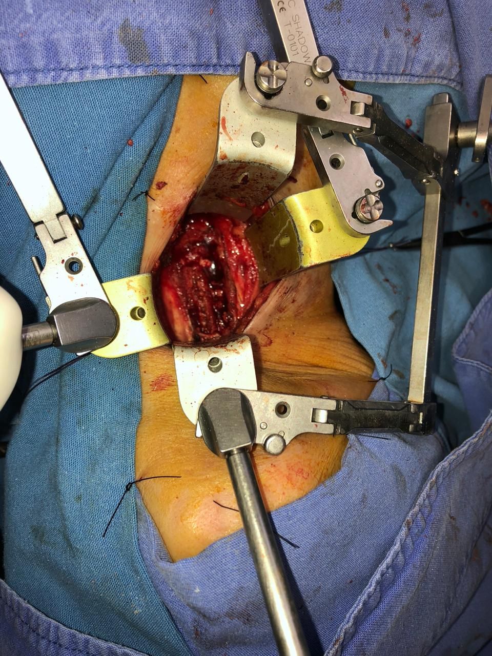 Juan José Luévano De La Cruz-13