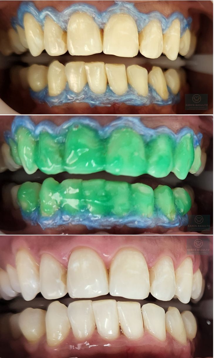 Ana Karen Basulto Cruz-0