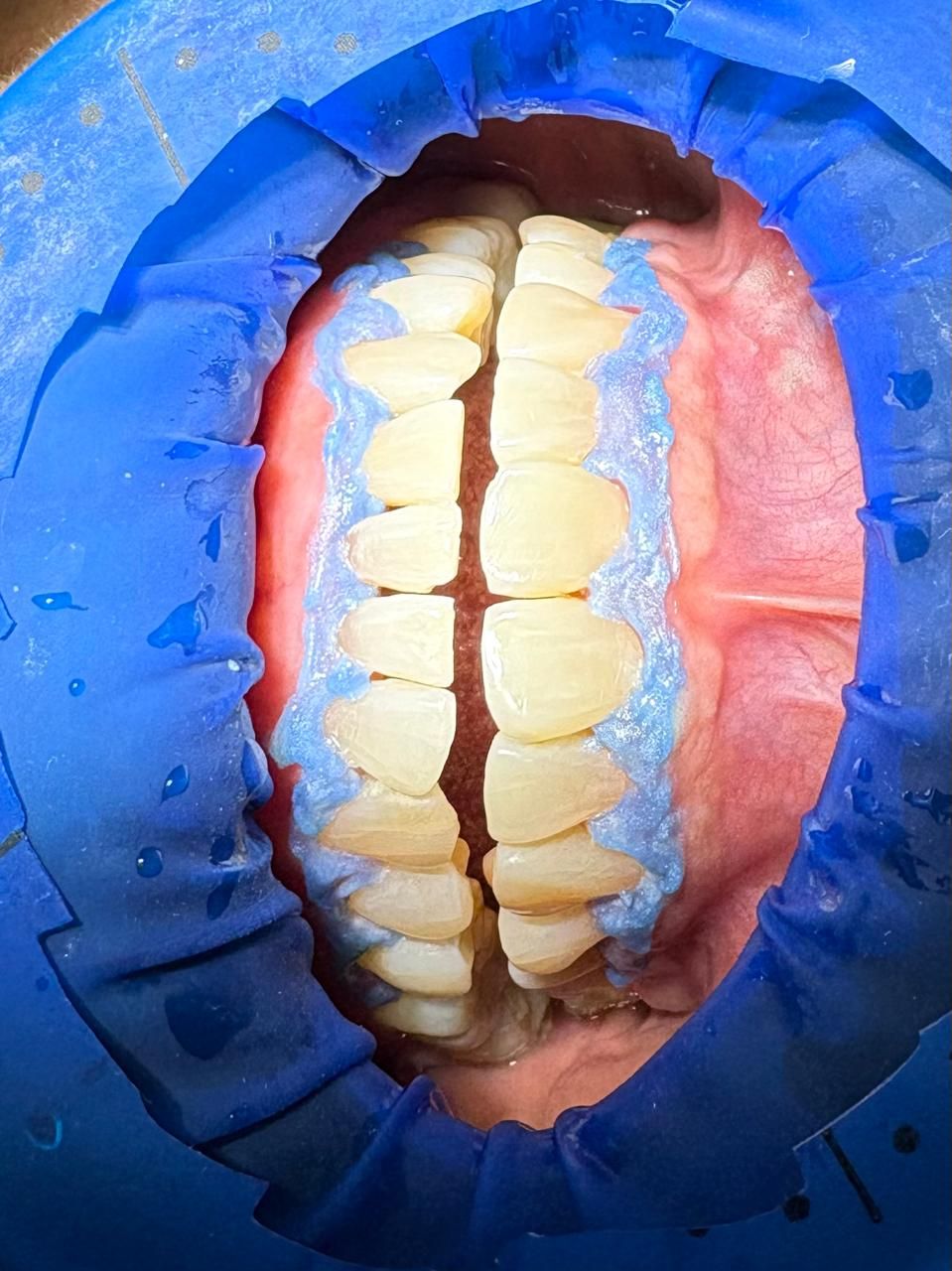 Arturo Romero Grande-42