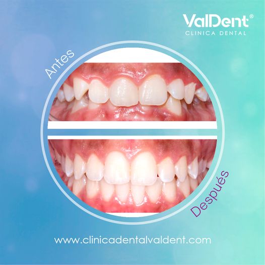 Karla Valdespino Gutierrez-4