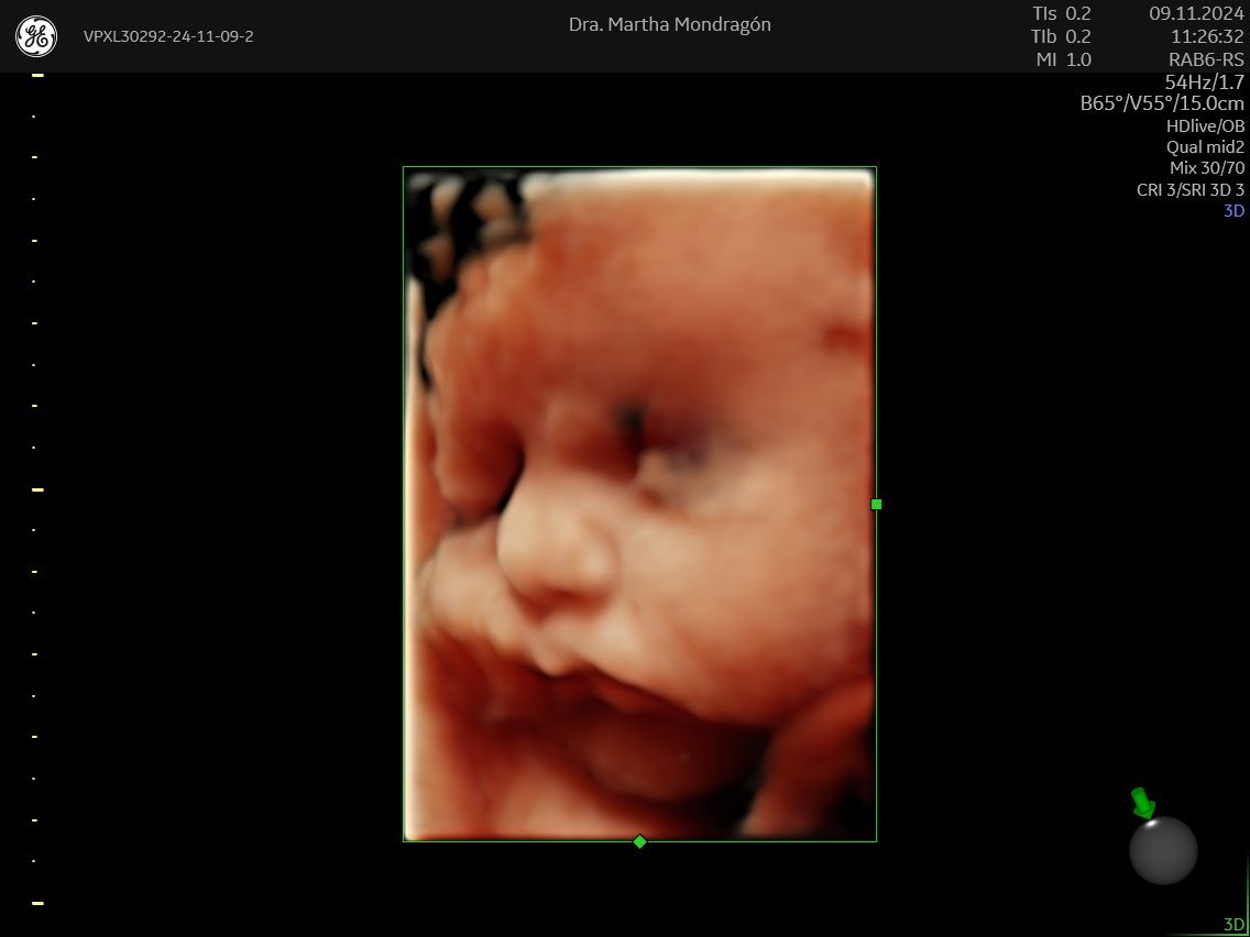 Martha Ivón Mondragón Cervantes-2