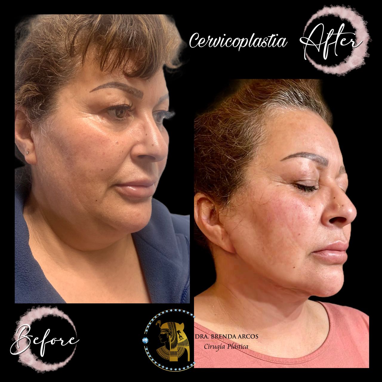 Brenda Arcos Vera-24