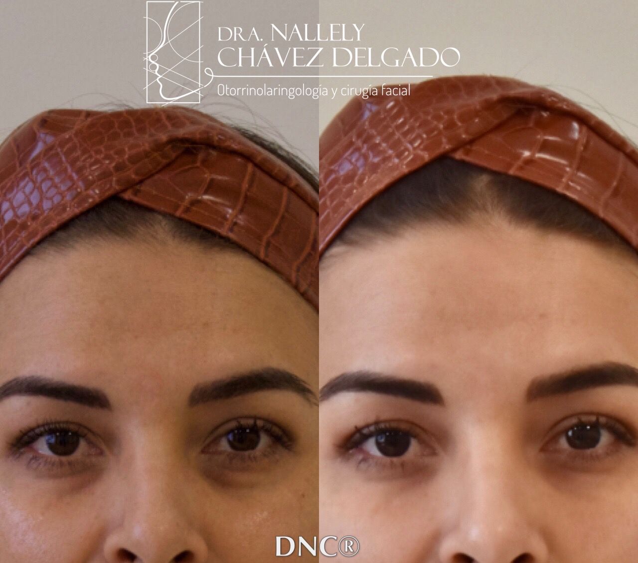 Nallely Chávez Delgado-14