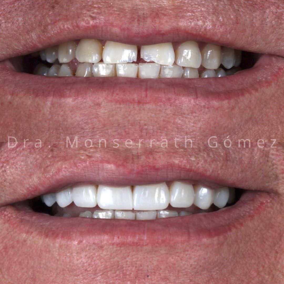 Monserrath Gomez Mendez-3