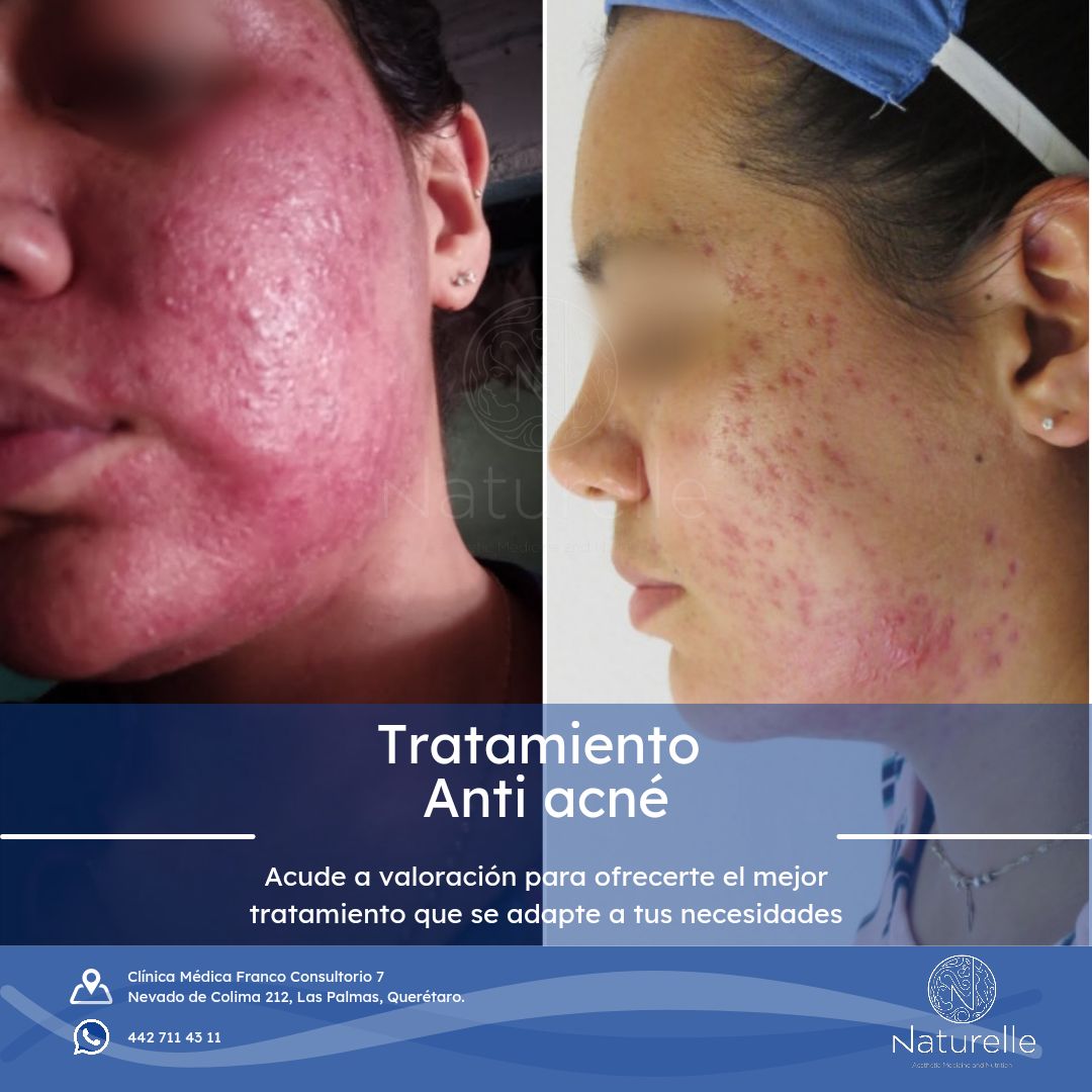 Daniel Marín Jasso-26