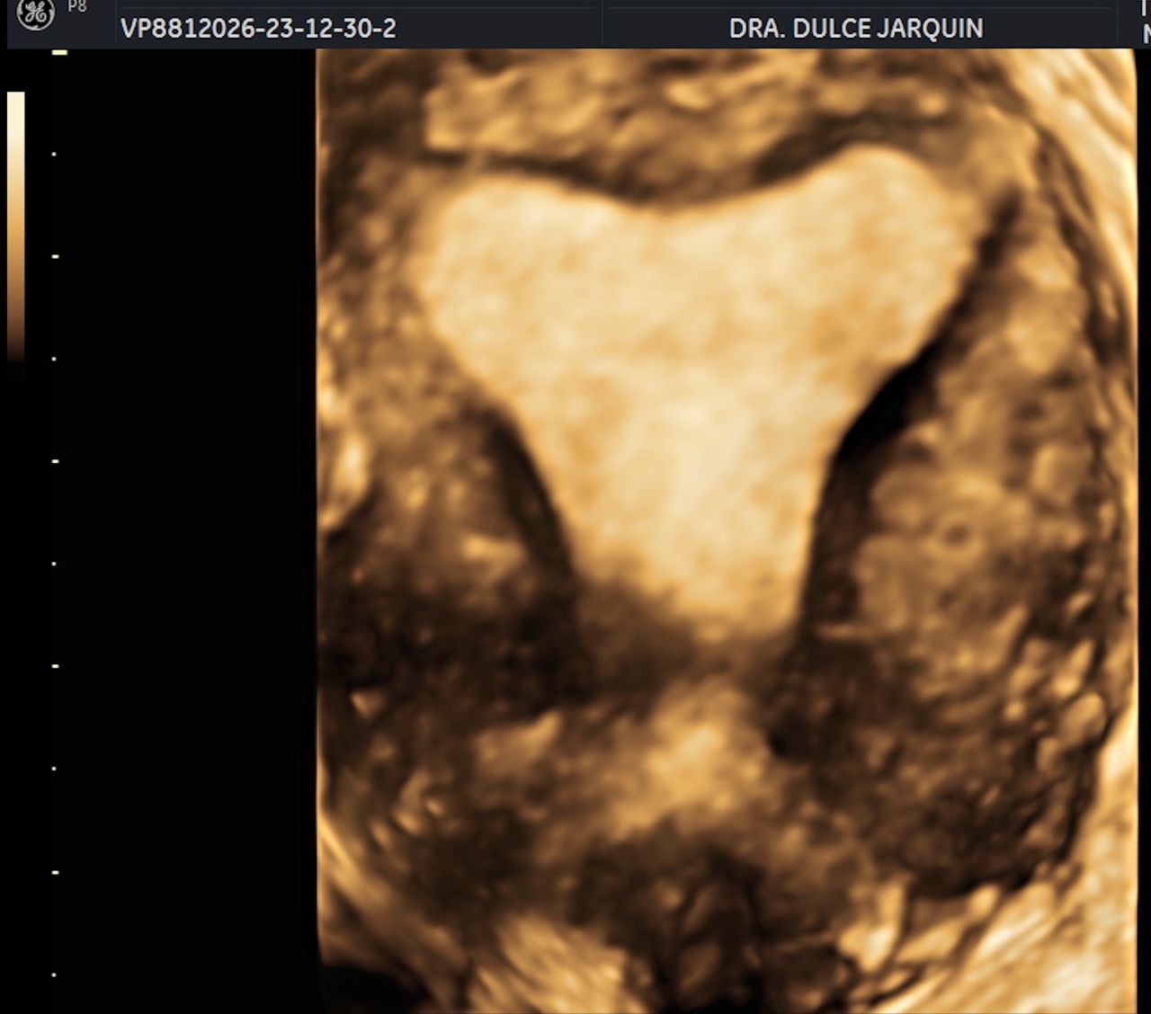 Dulce Anabel Jarquin Arango-25