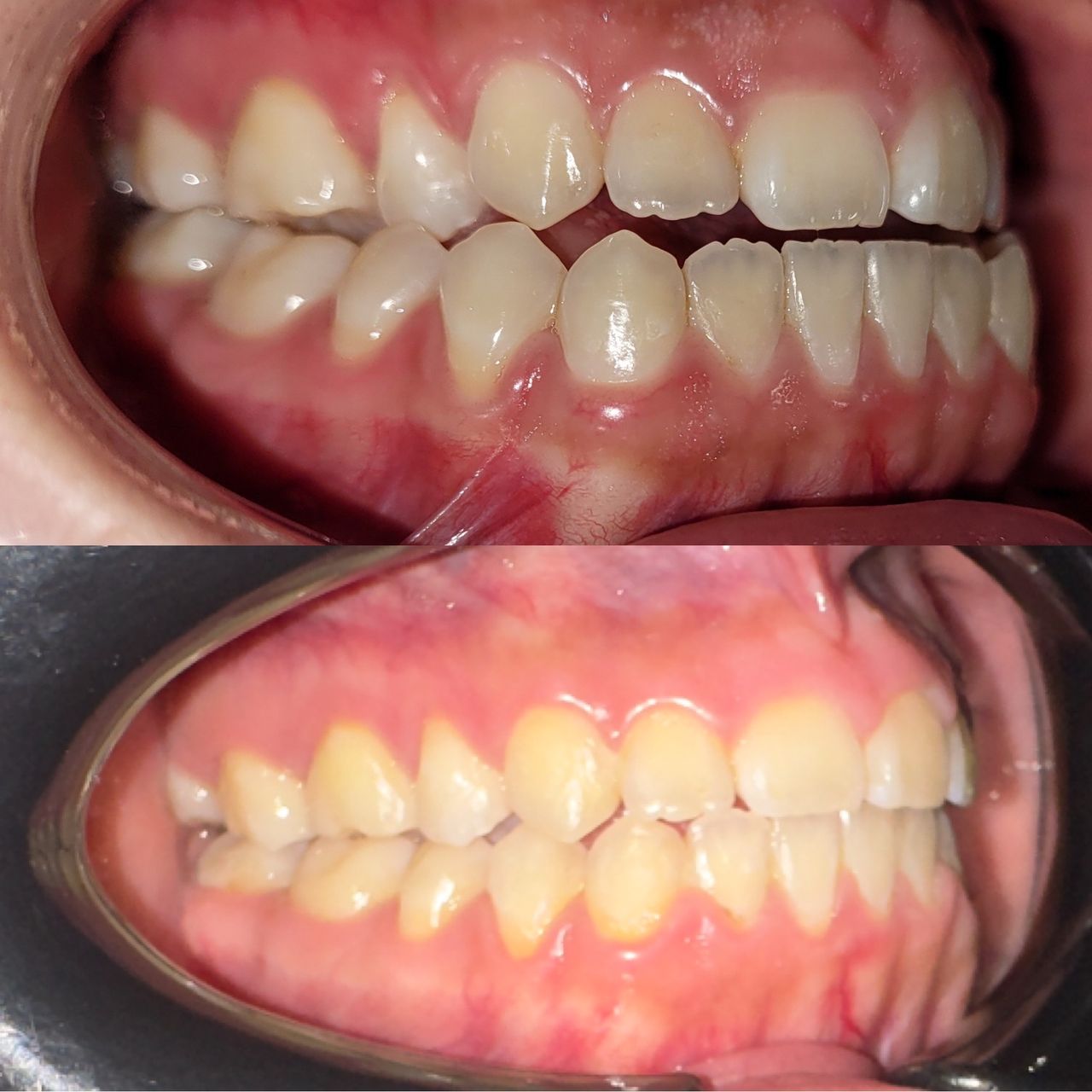 Marvin Adair Hernández Álvarez-16