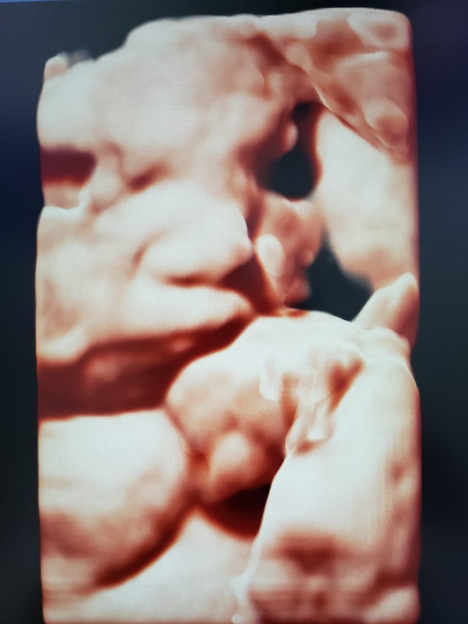 Adrian Estrada Campos-1