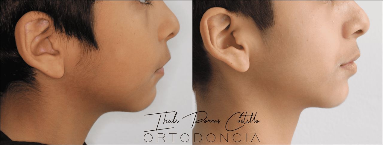 Ihali Porras Castillo-5