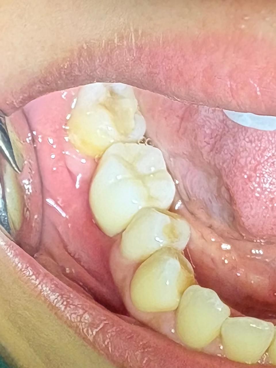 Arturo Romero Grande-32