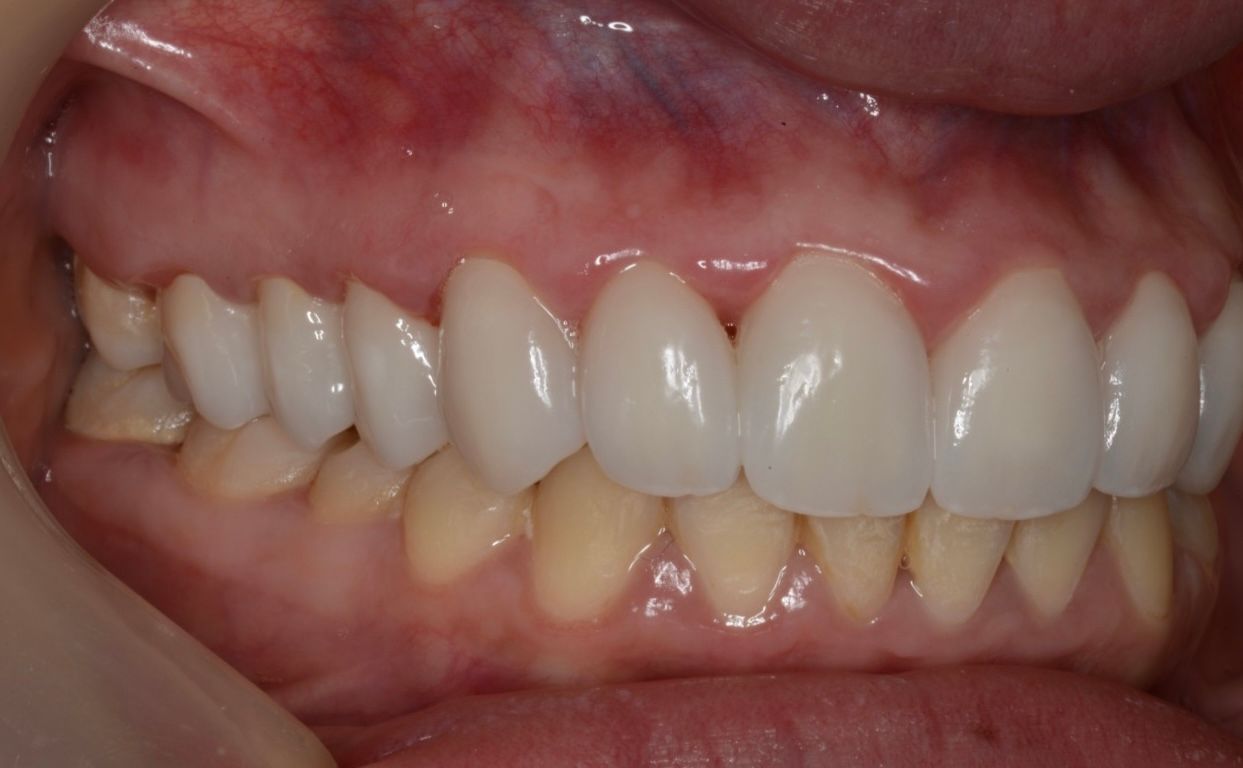 Sergio Bencomo Angulo-3