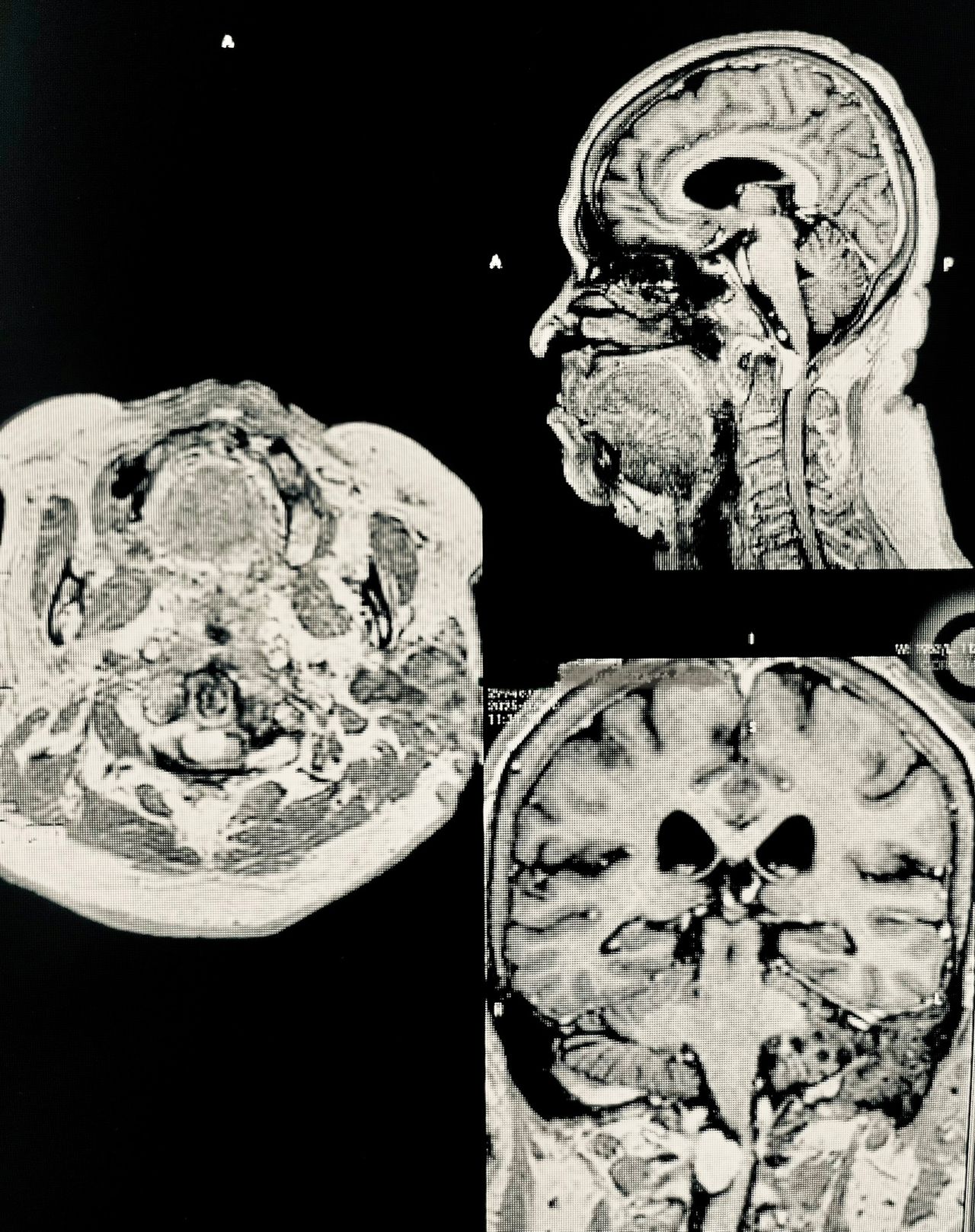 Juan Antonio Alvaro Heredia-13