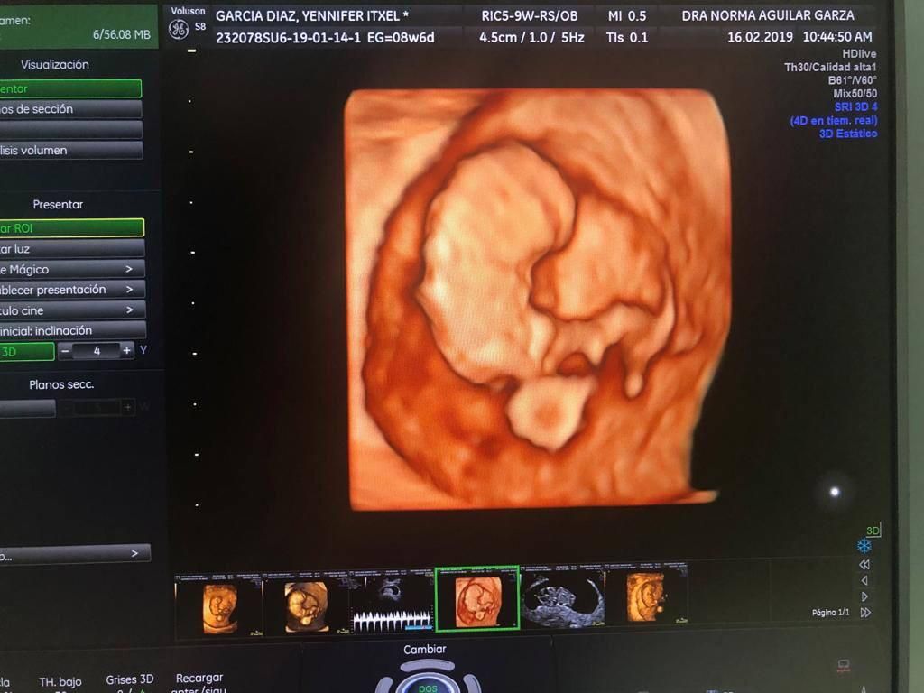 Norma Aguilar Garza-4