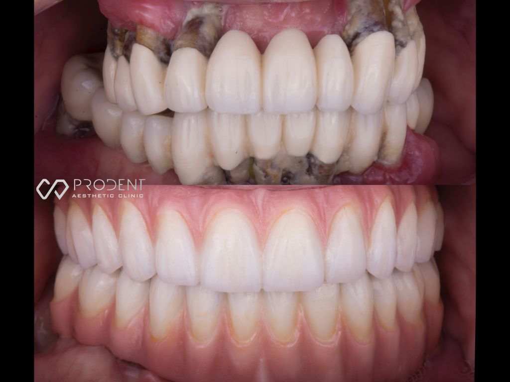 Ulises Pérez Murillo-49