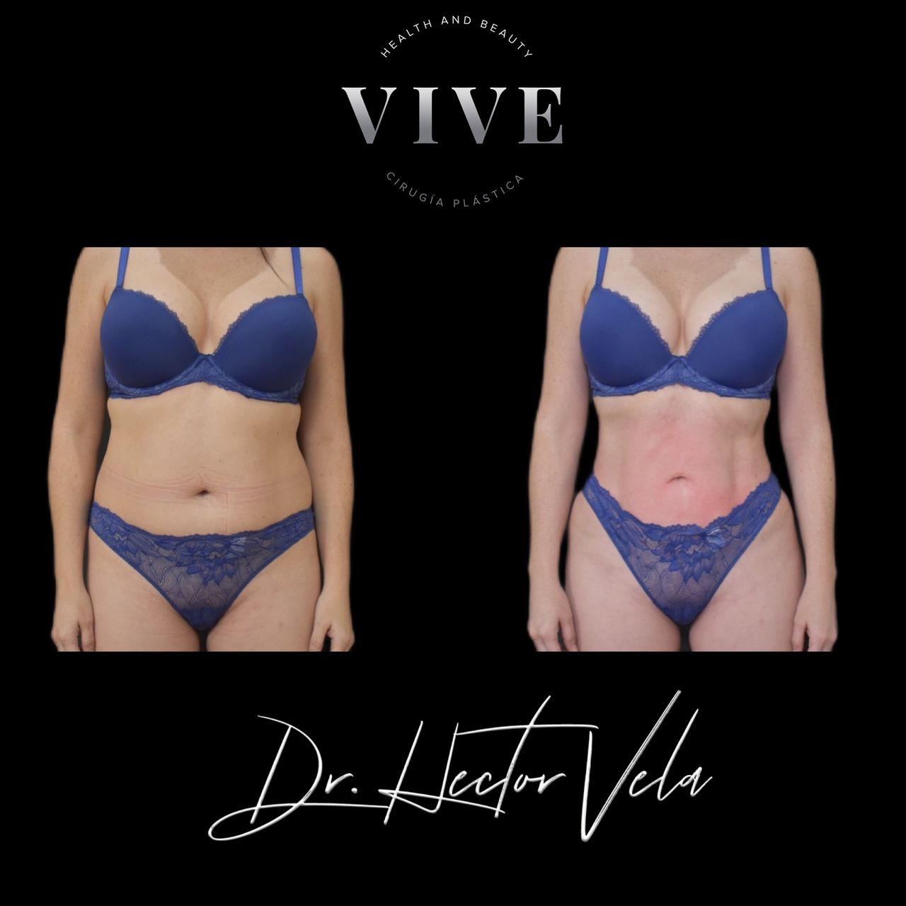 Héctor Eduardo Vela Cardona-107