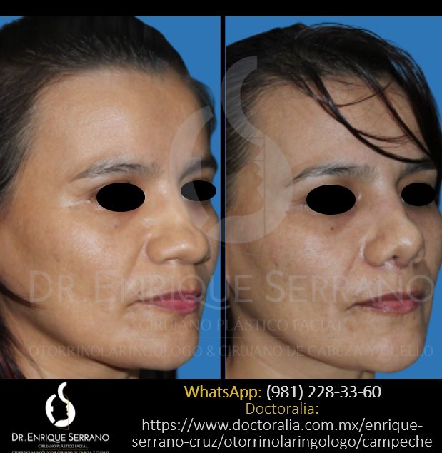 Enrique Serrano Cruz-54