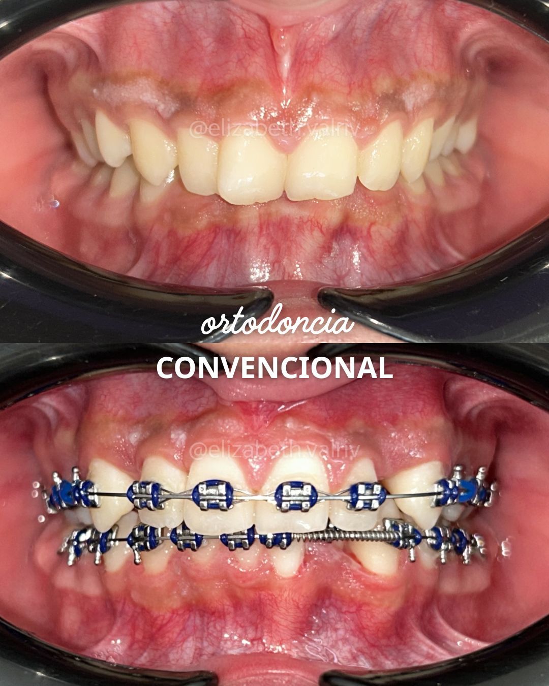 Elizabeth Valenzuela Rivera-5