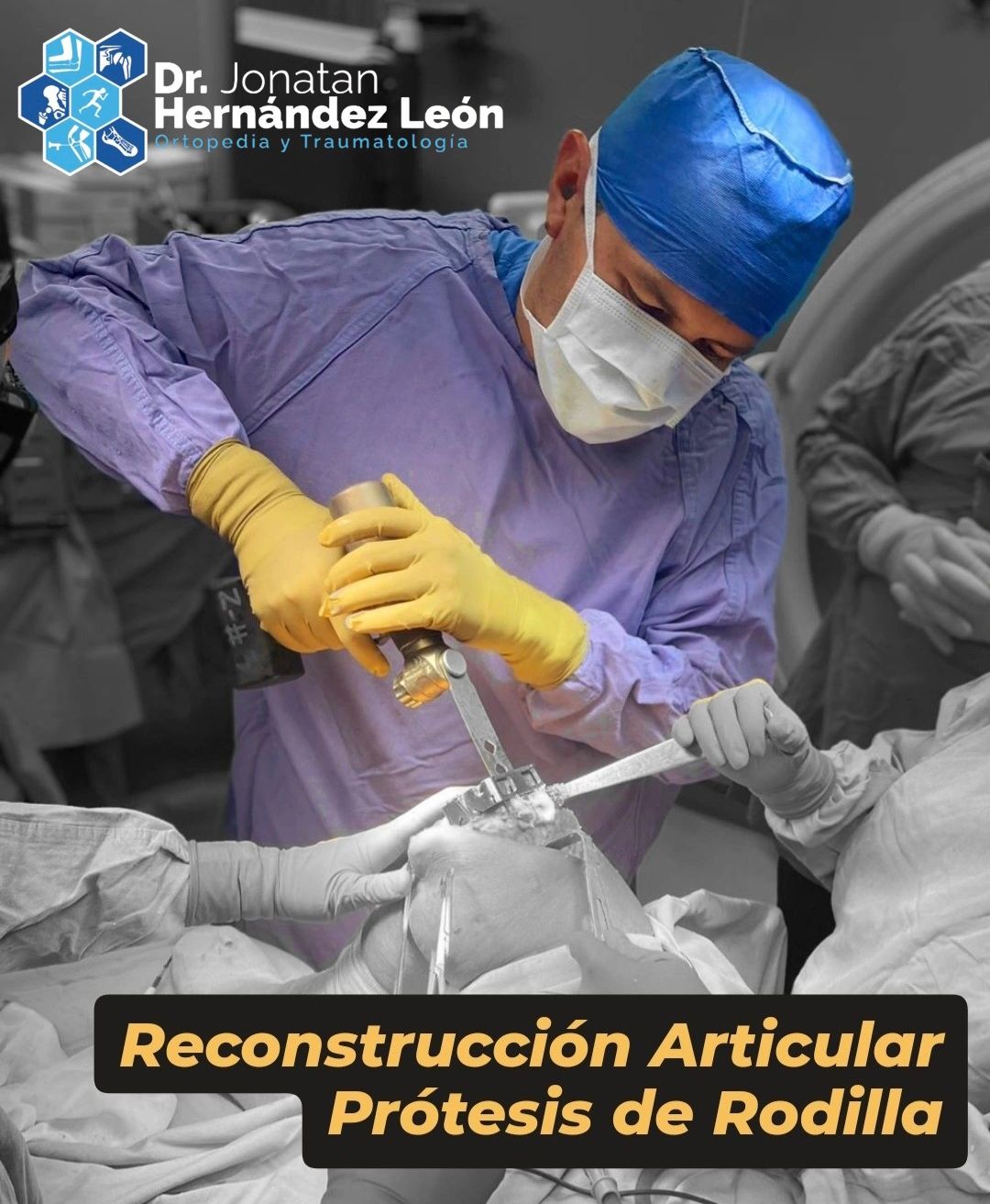 Jonatan Hernández León-40