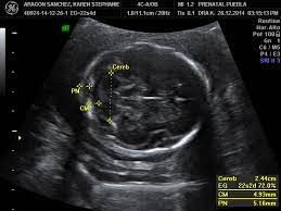 Rubén Chapa Téllez-1