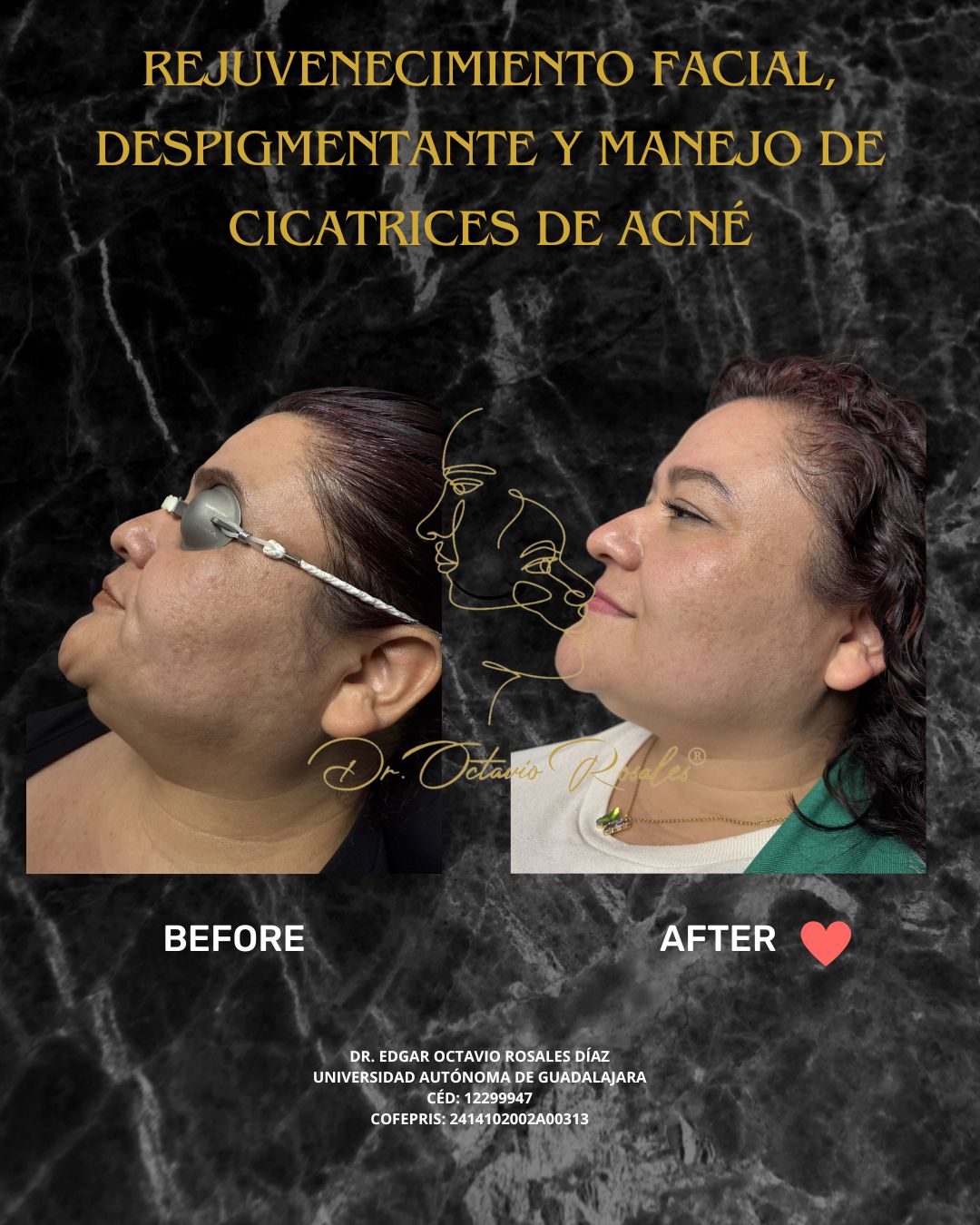 Edgar Octavio Rosales Diaz-17