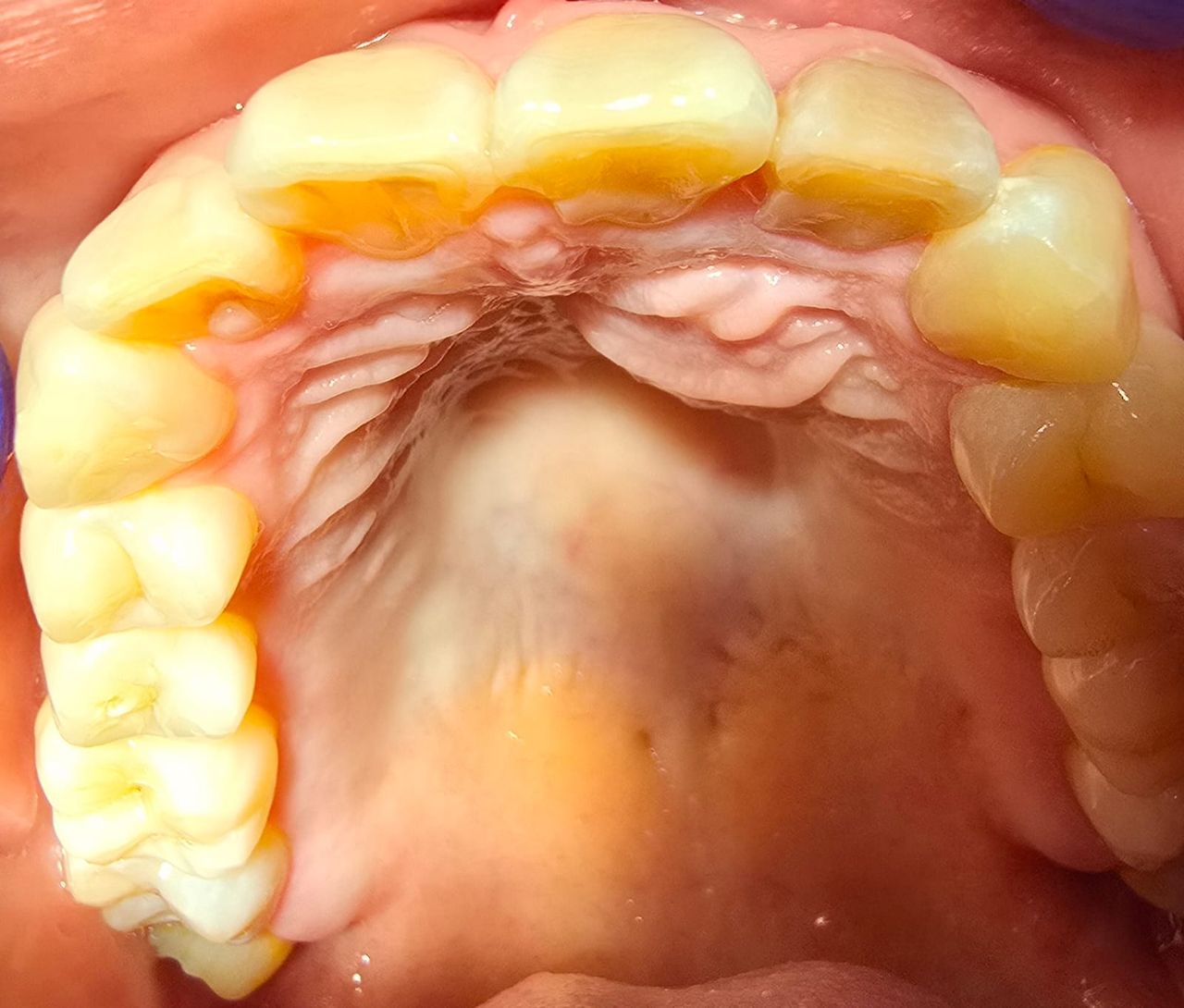 Juan Angel Cruz Rodríguez-12