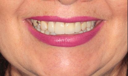 Mariel Itzayani Torres López-14