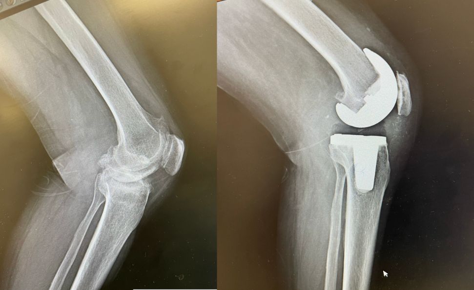 Diego Armando Contreras Rojas-10