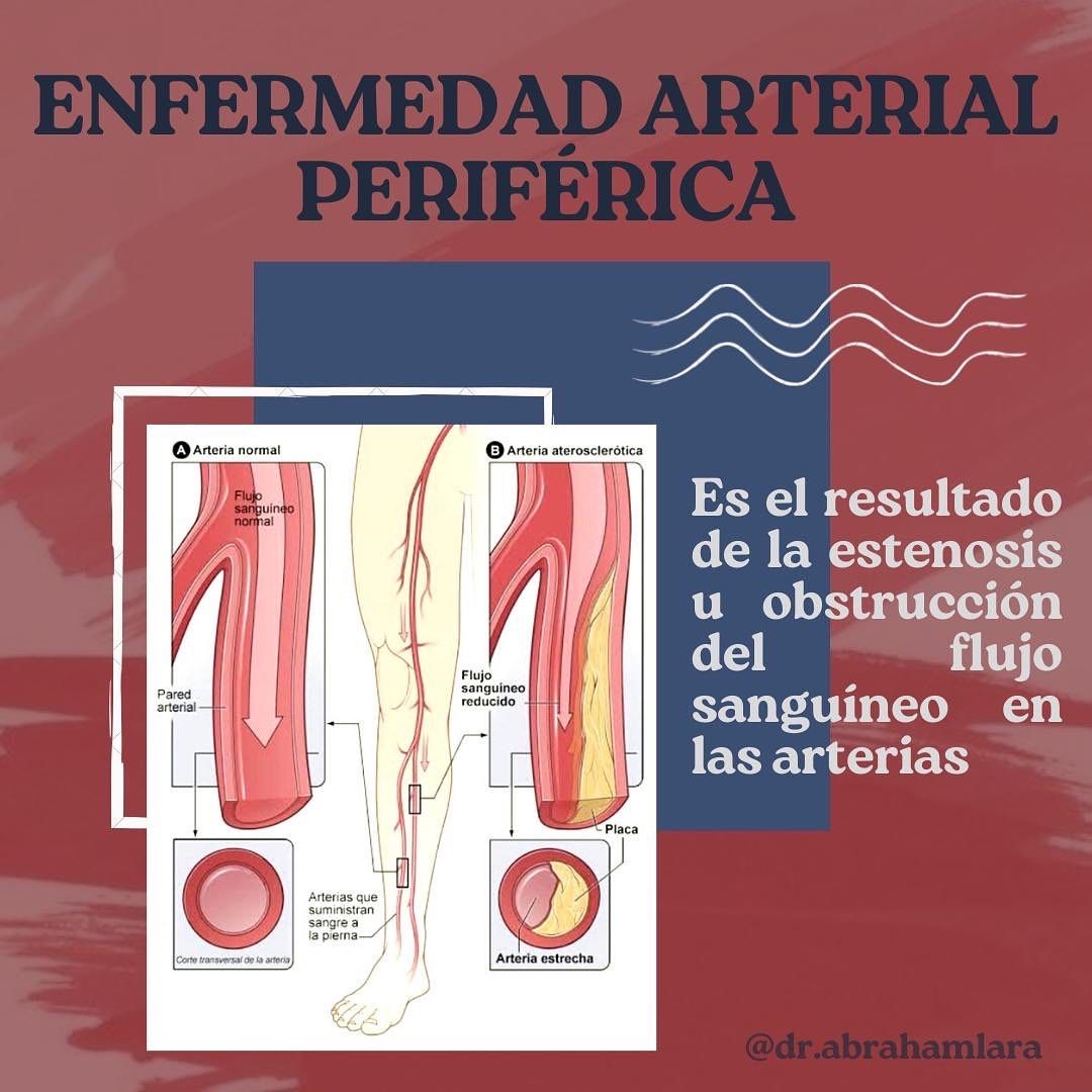 Miguel Abraham Lara Perez-28