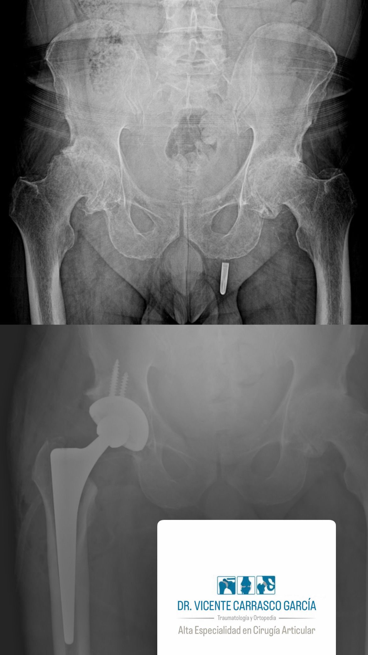 Vicente Carrasco García-7