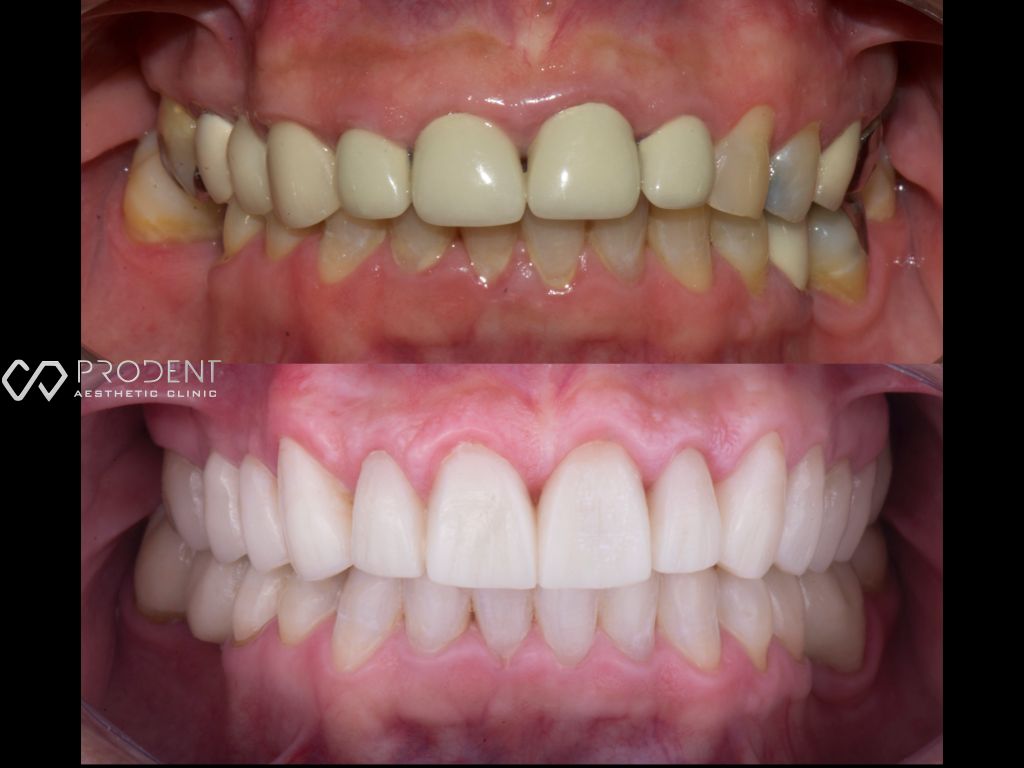 Ulises Pérez Murillo-60