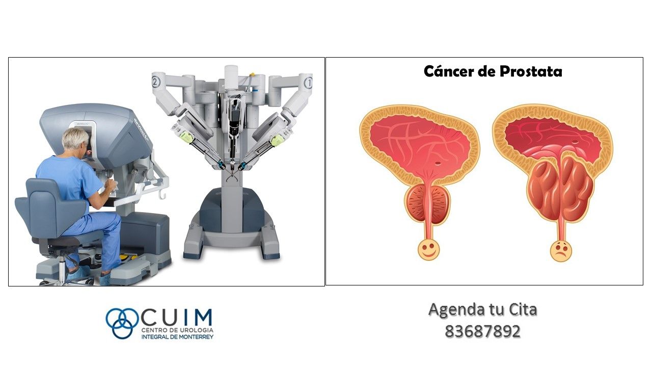 Alberto Colorado García-5