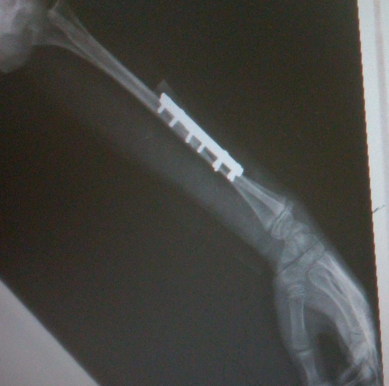 Juan José Luévano De La Cruz-45