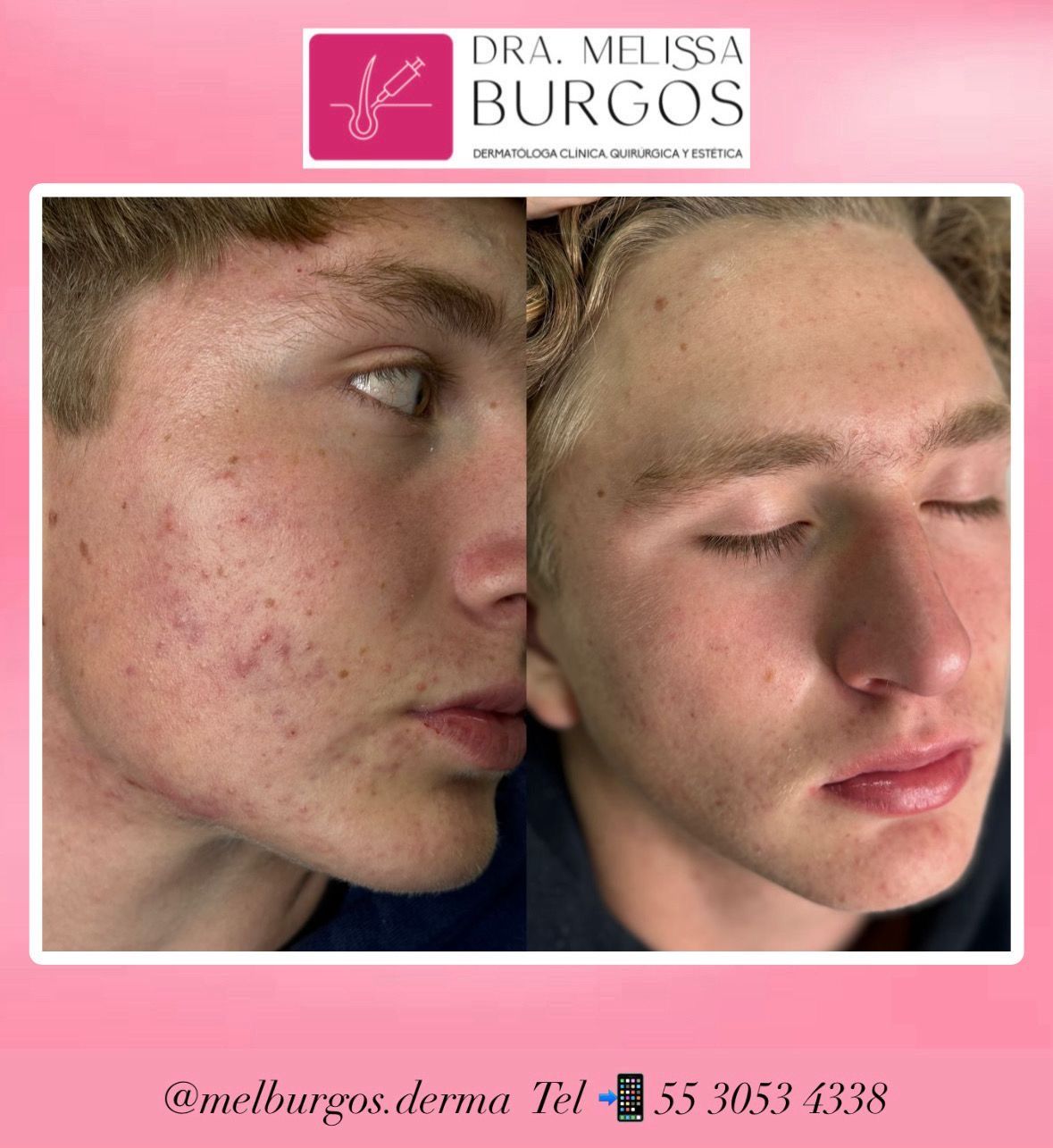 Melissa Burgos Romero-3