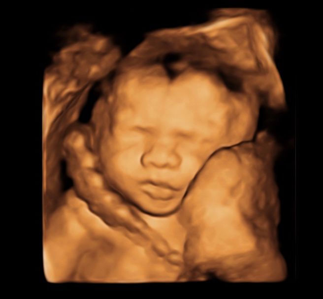 Zabdy Shirel H. Lascurain-6