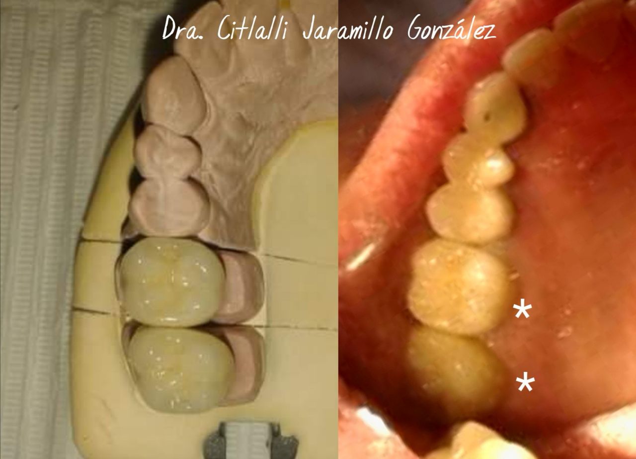 Citlalli Jaramillo González-7