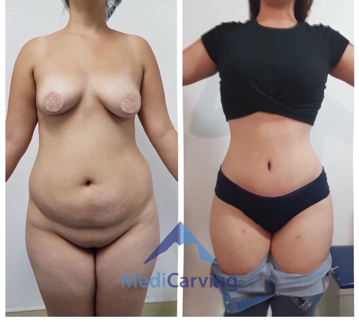 Rafael Velázquez Razo-8