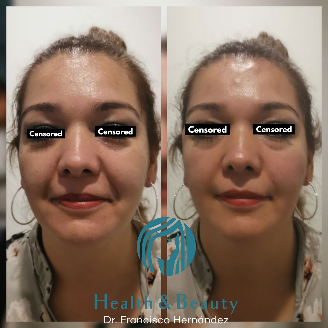 Francisco Hernández Gómez Crespo-180