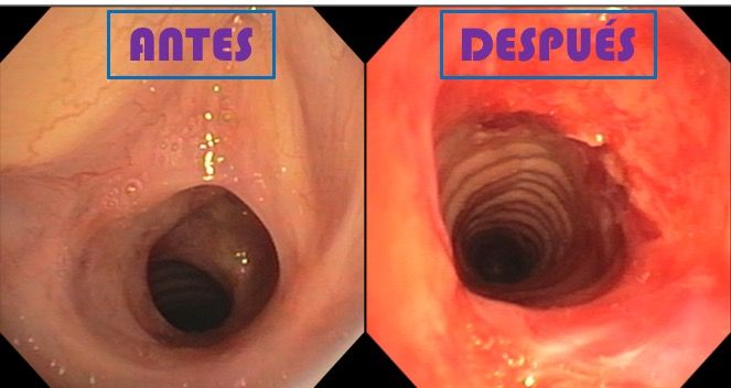 Baltazar Pech Alonso-13