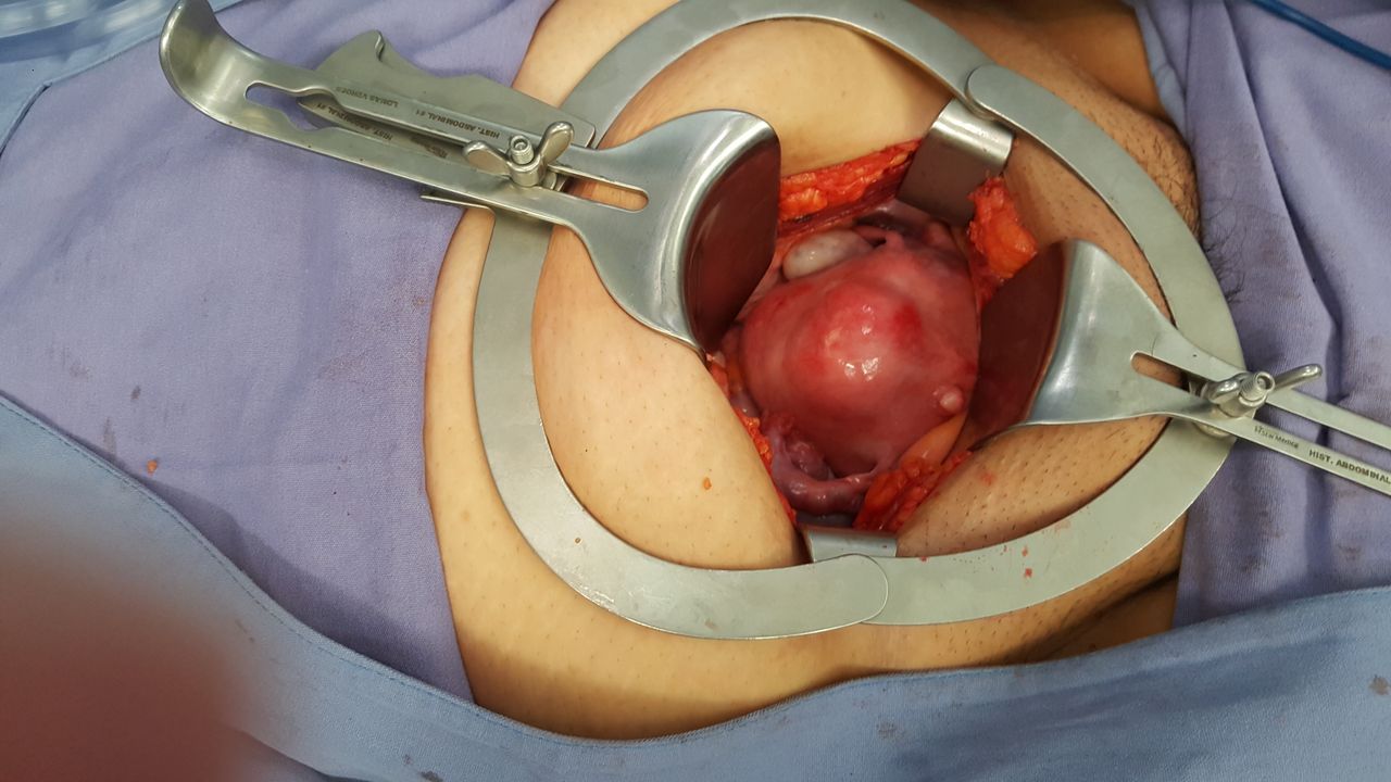 Ángel Millán Juárez-33