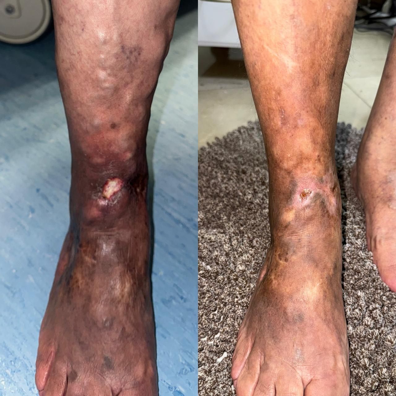 Jhonatan López González-23