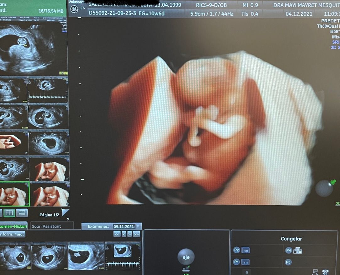 Mayi Mayret Mesquiti-8