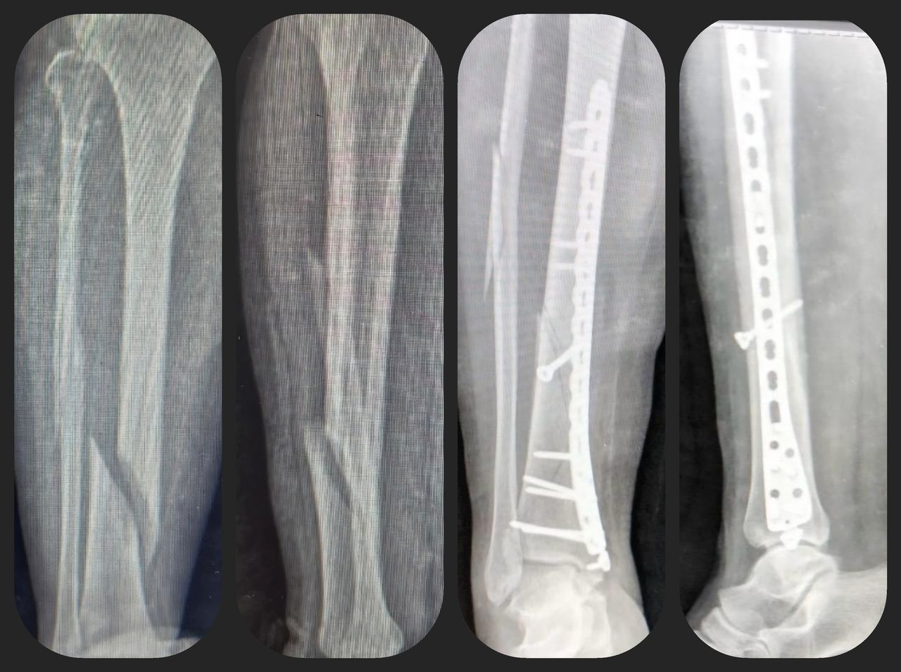 Amando Ramirez Zavala-8