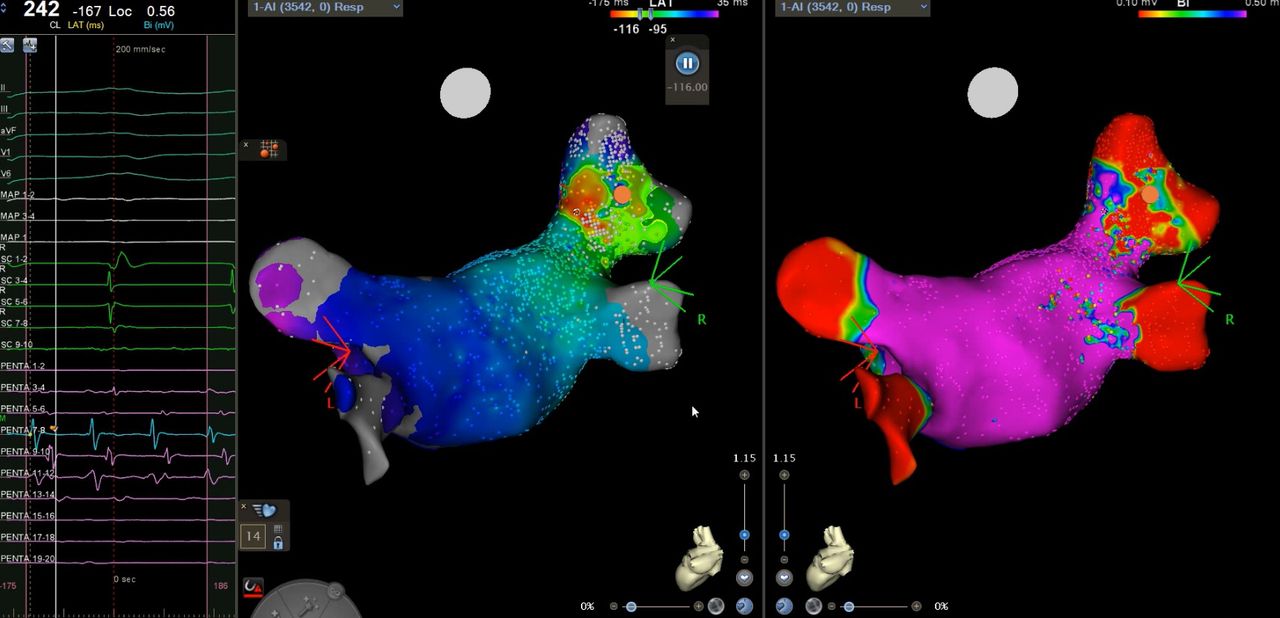 Elias Terrazas Cervantes-3